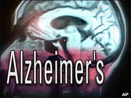 alzheimers
